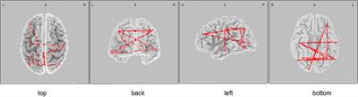 Genetic Association Between Alzheimer’s Disease Risk Variant of the PICALM Gene and EEG Functional Connectivity in Non-demented Adults